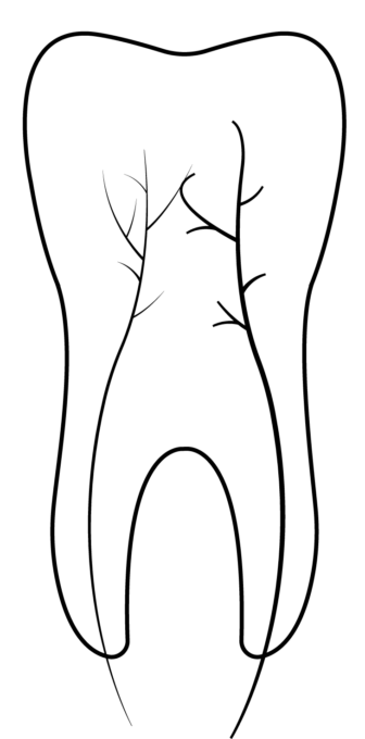 Endodontics Root Canal