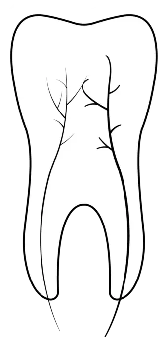 Endodontics Root Canal